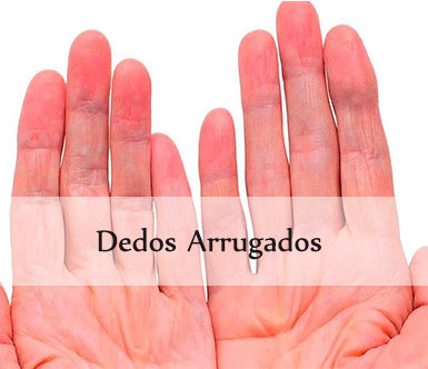 dedos arrugados